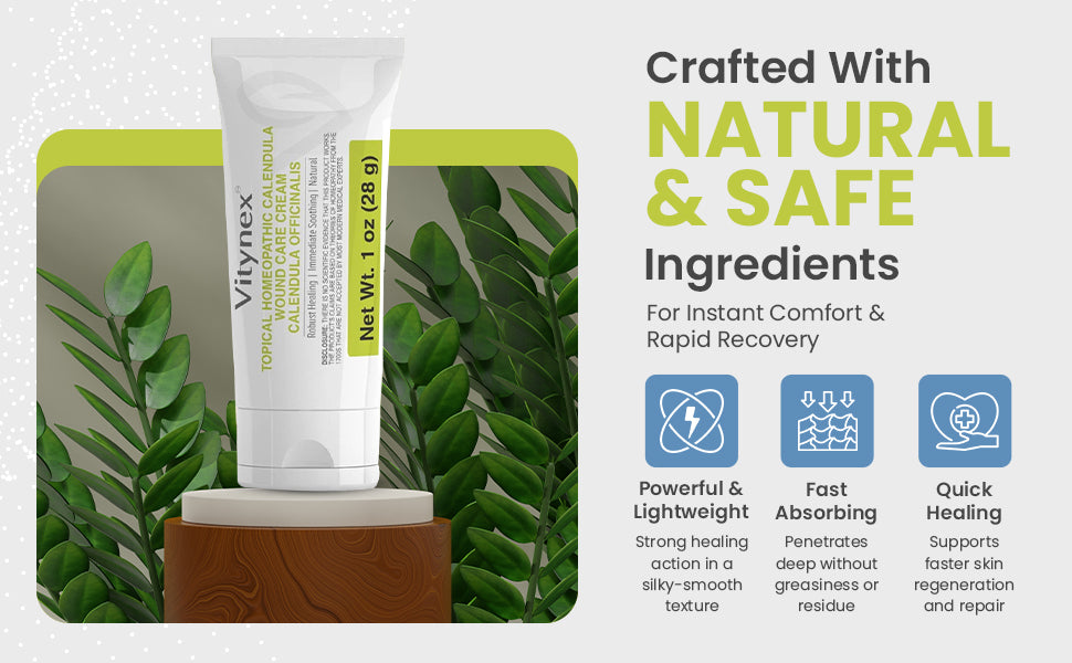 Natural calendula wound care cream for bed sores and pressure ulcers