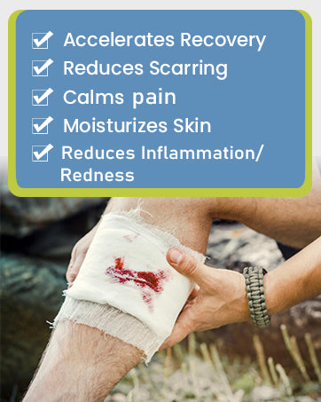 Vitynex wound care ointment – a must-have first aid kit essential